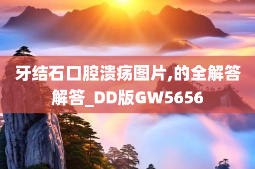 牙结石口腔溃疡图片,的全解答解答_DD版GW5656